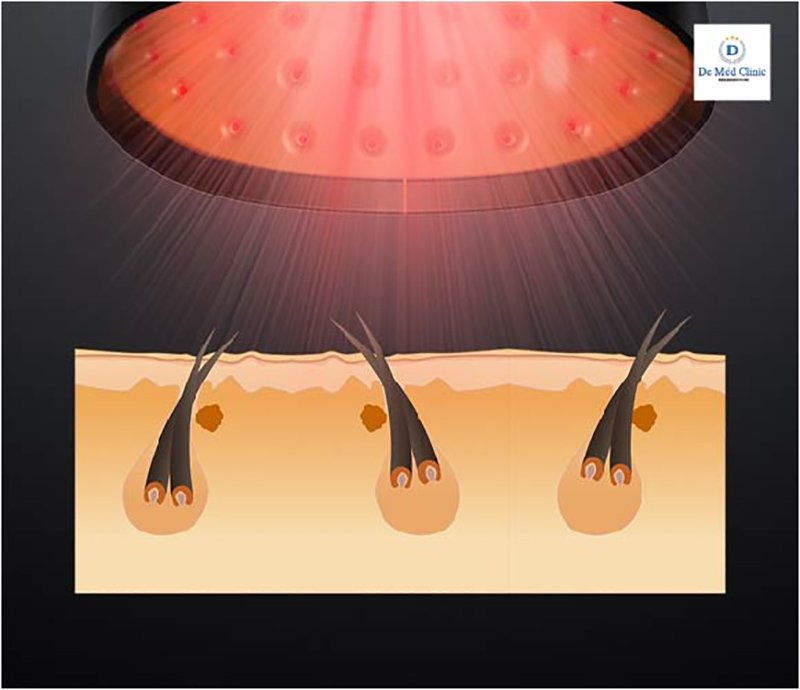 Unbox Xiaomi Cosbeauty LLLT Cap Unbox Xiaomi Cosbeauty LLLT Cap