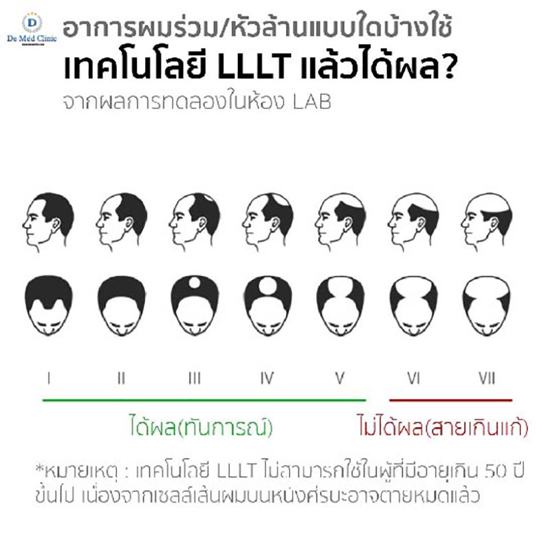 Unbox Xiaomi Cosbeauty LLLT Cap Unbox Xiaomi Cosbeauty LLLT Cap