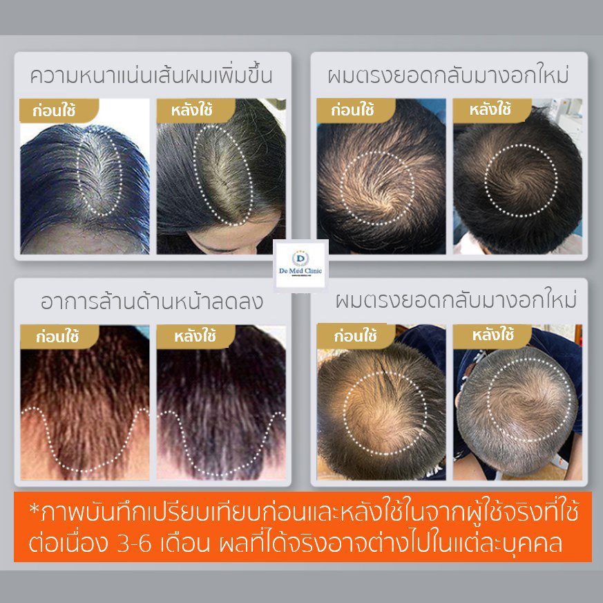 Unbox Xiaomi Cosbeauty LLLT Cap Unbox Xiaomi Cosbeauty LLLT Cap