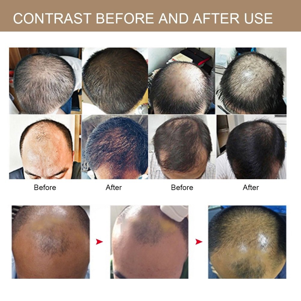 Unbox Xiaomi Cosbeauty LLLT Cap Unbox Xiaomi Cosbeauty LLLT Cap