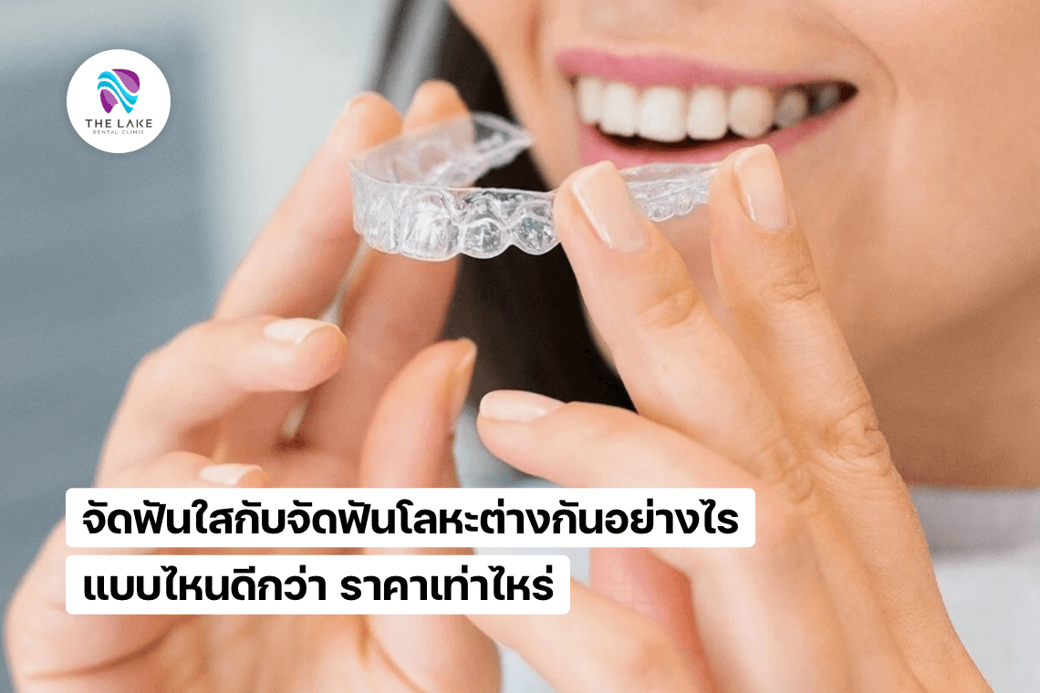 จัดฟันใสกับจัดฟันโลหะ แบบไหนดีกว่า ราคาเท่าไหร่ จัดฟันใสกับจัดฟันโลหะ แบบไหนดีกว่า ราคาเท่าไหร่