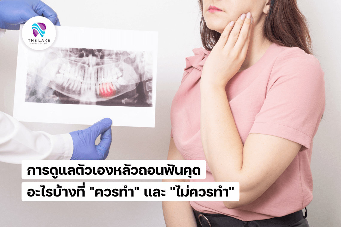 การดูแลตัวเองหลังผ่าฟันคุด การดูแลตัวเองหลังผ่าฟันคุด