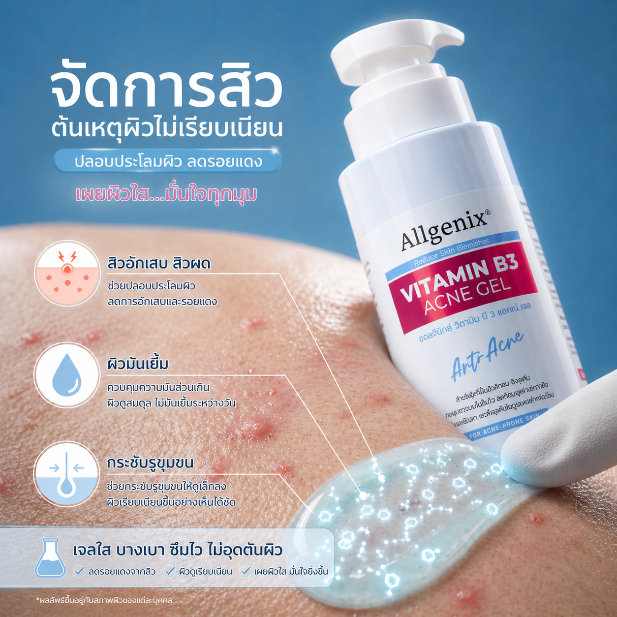 Vitamin B3 Acne Gel