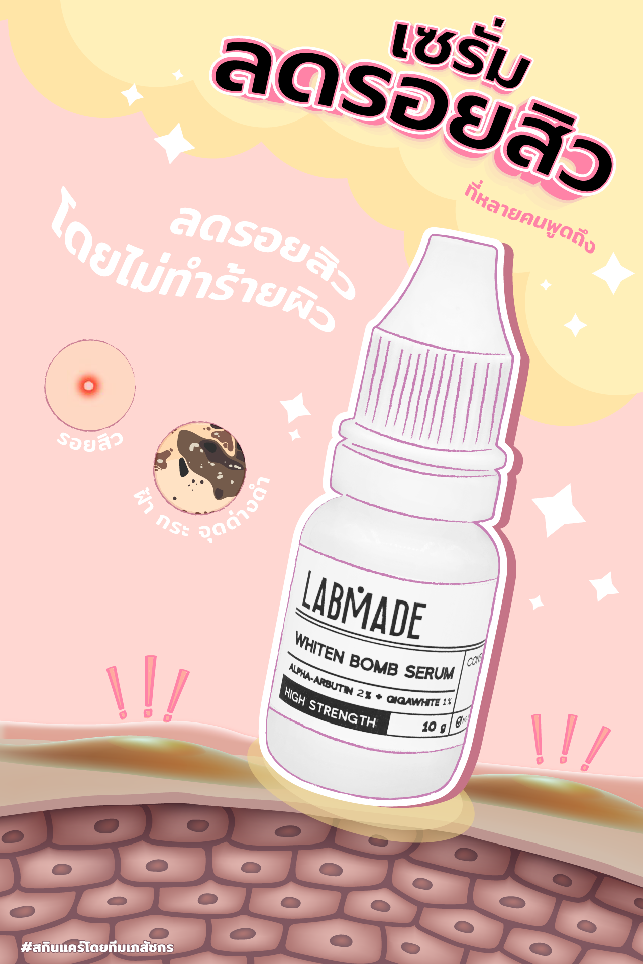 เซรั่มลดรอยสิว