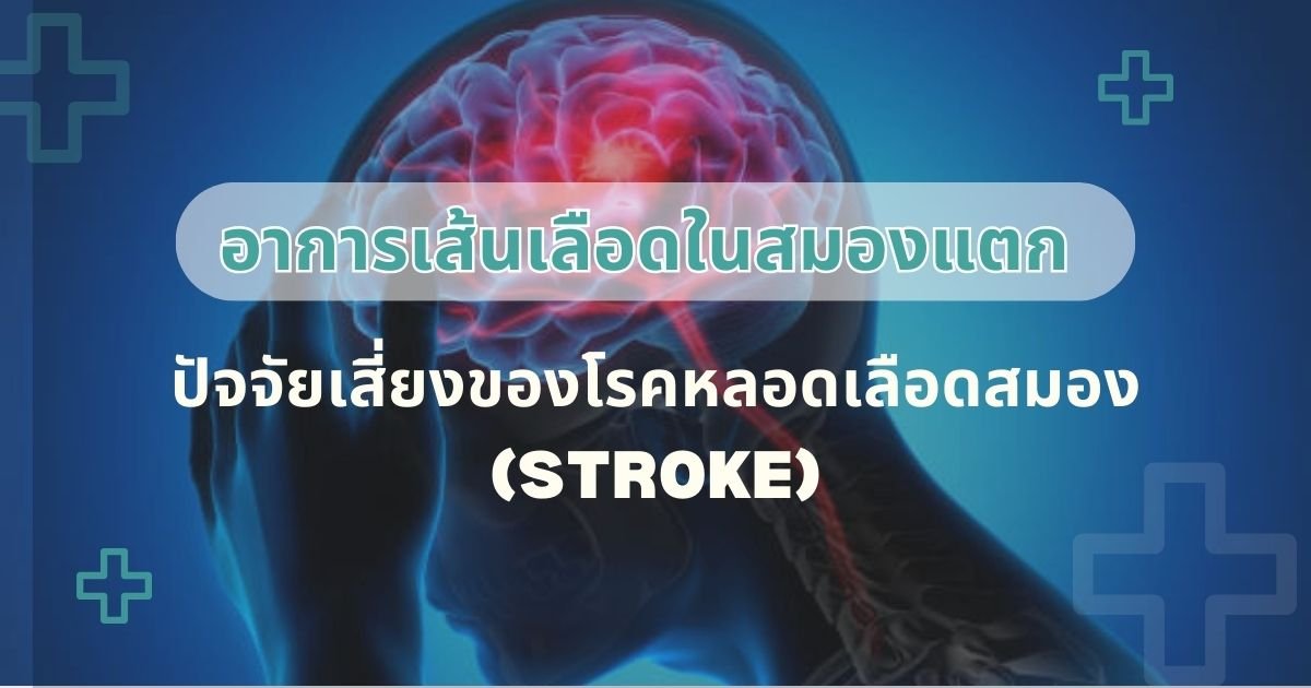 Stroke