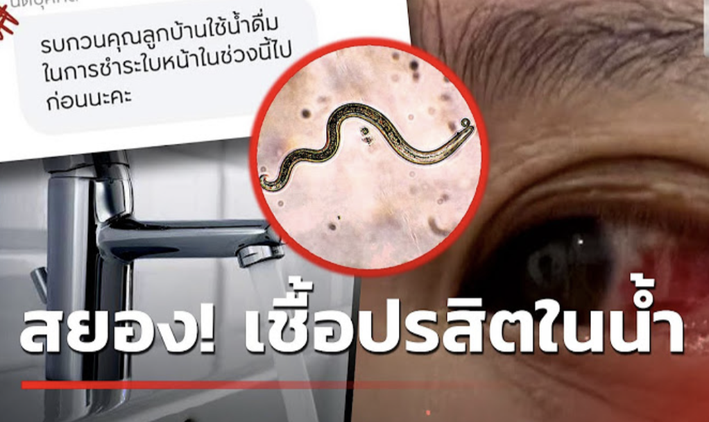 Parasites found in water at a condominium in Bangkok, more than 200 residents suffer from red eye