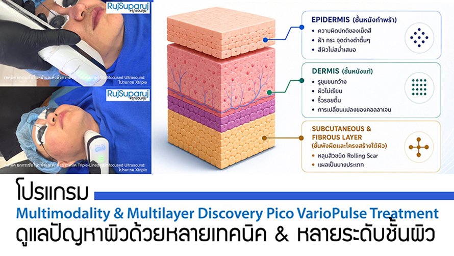 โปรแกรม Multimodality & Multilayer Discovery Pico VarioPulse Treatment