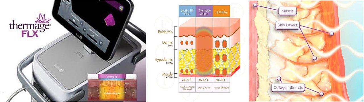 Thermage FLX Body Tip กระชับสัดส่วน (เทอมาจนวัตกรรมใหม่ล่าสุด) Thermage FLX Body Tip กระชับสัดส่วน (เทอมาจนวัตกรรมใหม่ล่าสุด)