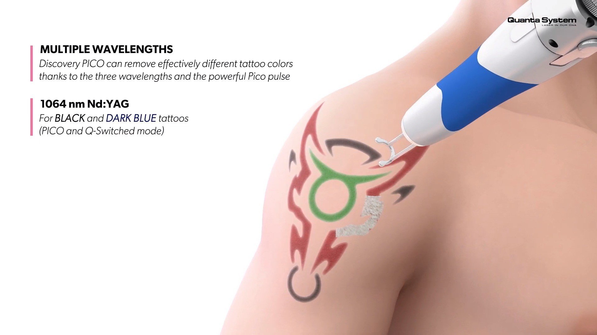 ทำความรู้จัก Discovery Pico Laser เทคนิค จุดเด่นในการดูแลรักษาปัญหาผิวหนัง หลุมสิว รูขุมขนกว้าง กระฝ้า จุดด่างดำ รอยสัก ทำความรู้จัก Discovery Pico Laser เทคนิค จุดเด่นในการดูแลรักษาปัญหาผิวหนัง หลุมสิว รูขุมขนกว้าง กระฝ้า จุดด่างดำ รอยสัก