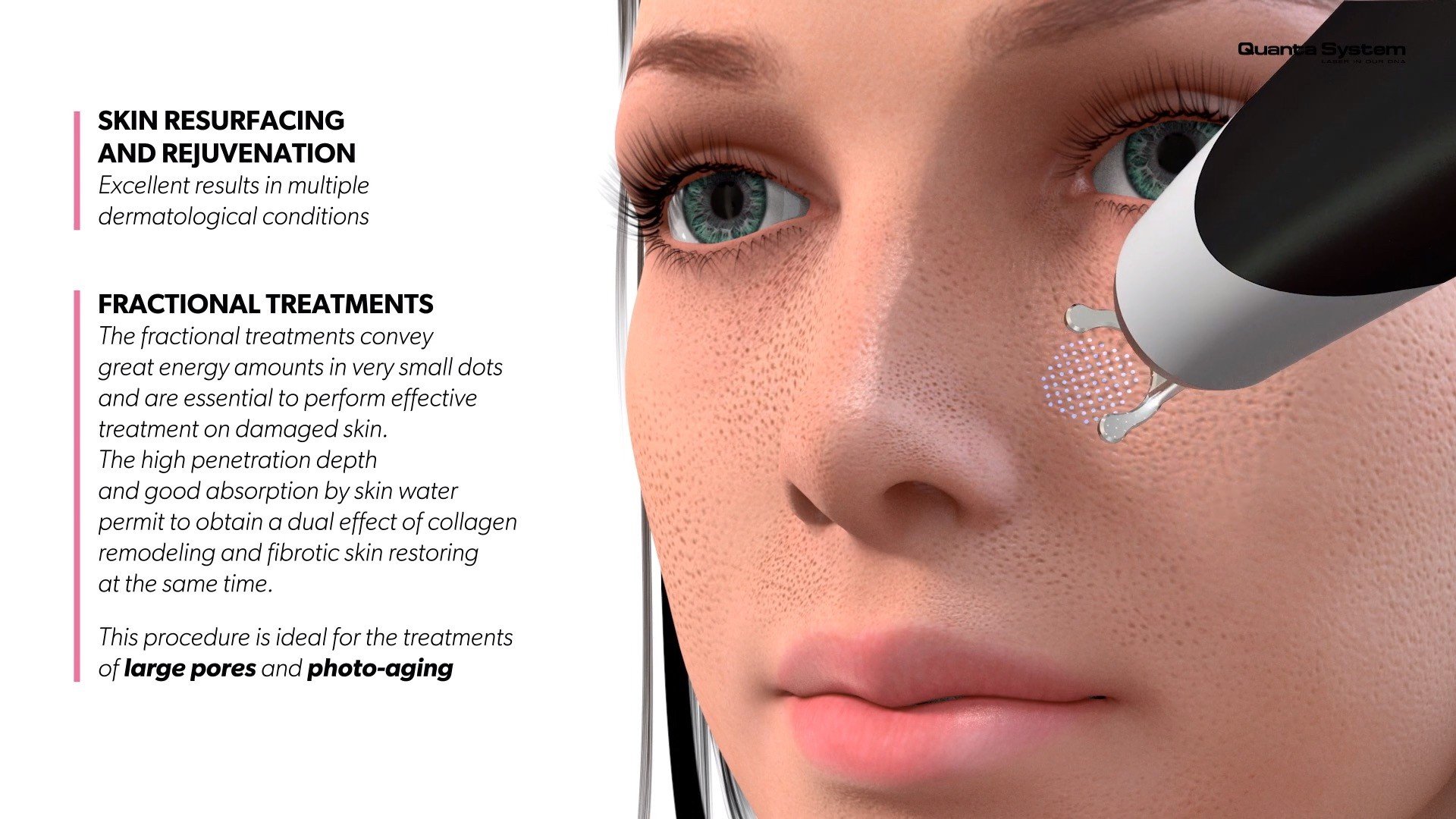 ทำความรู้จัก Discovery Pico Laser เทคนิค จุดเด่นในการดูแลรักษาปัญหาผิวหนัง หลุมสิว รูขุมขนกว้าง กระฝ้า จุดด่างดำ รอยสัก ทำความรู้จัก Discovery Pico Laser เทคนิค จุดเด่นในการดูแลรักษาปัญหาผิวหนัง หลุมสิว รูขุมขนกว้าง กระฝ้า จุดด่างดำ รอยสัก