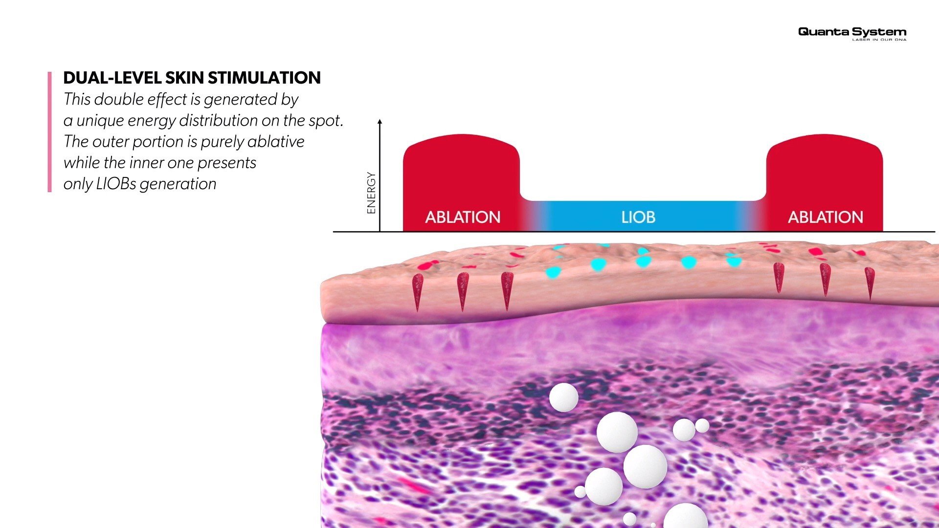 ทำความรู้จัก Discovery Pico Laser เทคนิค จุดเด่นในการดูแลรักษาปัญหาผิวหนัง หลุมสิว รูขุมขนกว้าง กระฝ้า จุดด่างดำ รอยสัก ทำความรู้จัก Discovery Pico Laser เทคนิค จุดเด่นในการดูแลรักษาปัญหาผิวหนัง หลุมสิว รูขุมขนกว้าง กระฝ้า จุดด่างดำ รอยสัก