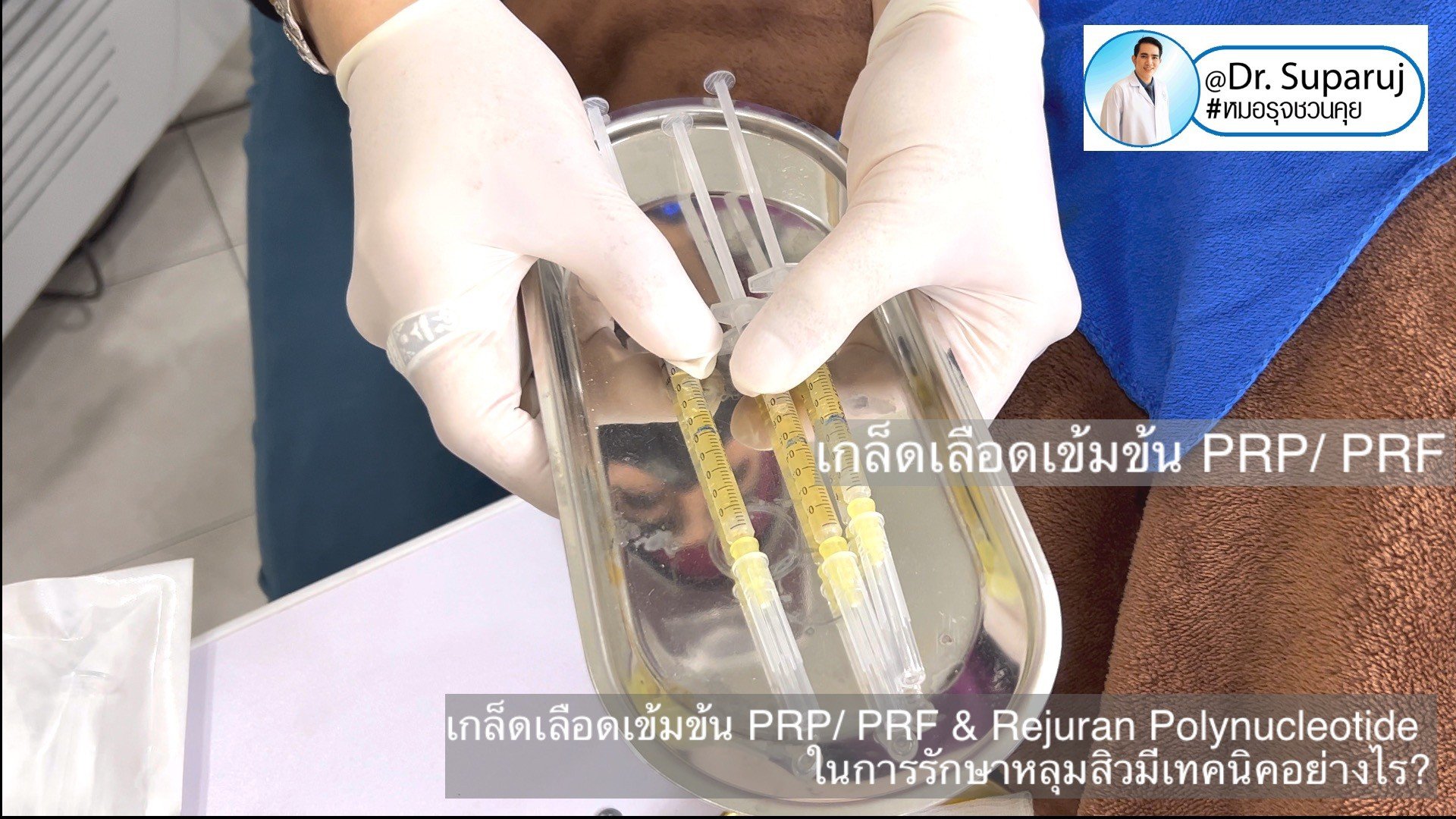 Update เทคนิคดูแลหลุมสิวด้วย Rejuran และ เกล็ดเลือดเข้มข้น PRP/PRF มีเทคนิคอย่างไร? เทคนิคไหนได้ผลดีกว่า ? Update เทคนิคดูแลหลุมสิวด้วย Rejuran และ เกล็ดเลือดเข้มข้น PRP/PRF มีเทคนิคอย่างไร? เทคนิคไหนได้ผลดีกว่า ?