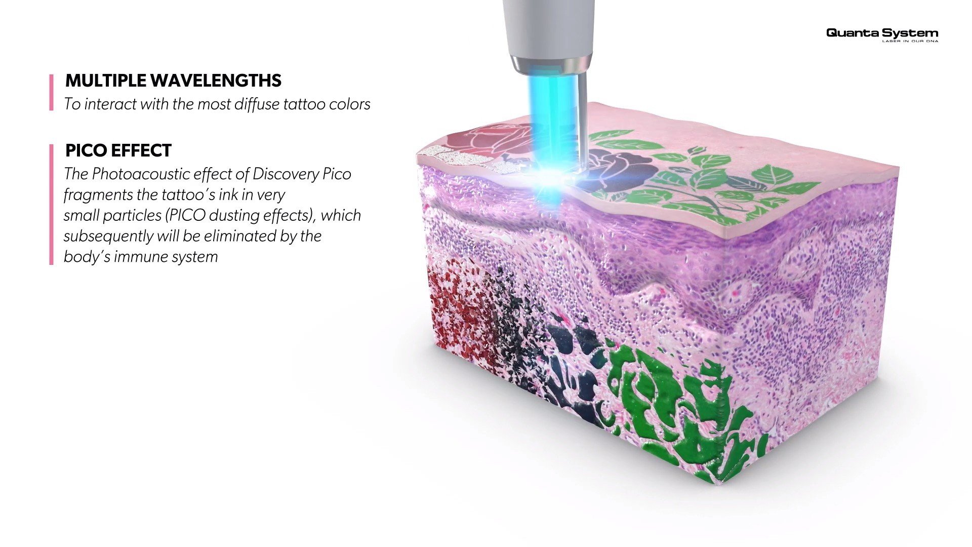 ทำความรู้จัก Discovery Pico Laser เทคนิค จุดเด่นในการดูแลรักษาปัญหาผิวหนัง หลุมสิว รูขุมขนกว้าง กระฝ้า จุดด่างดำ รอยสัก ทำความรู้จัก Discovery Pico Laser เทคนิค จุดเด่นในการดูแลรักษาปัญหาผิวหนัง หลุมสิว รูขุมขนกว้าง กระฝ้า จุดด่างดำ รอยสัก