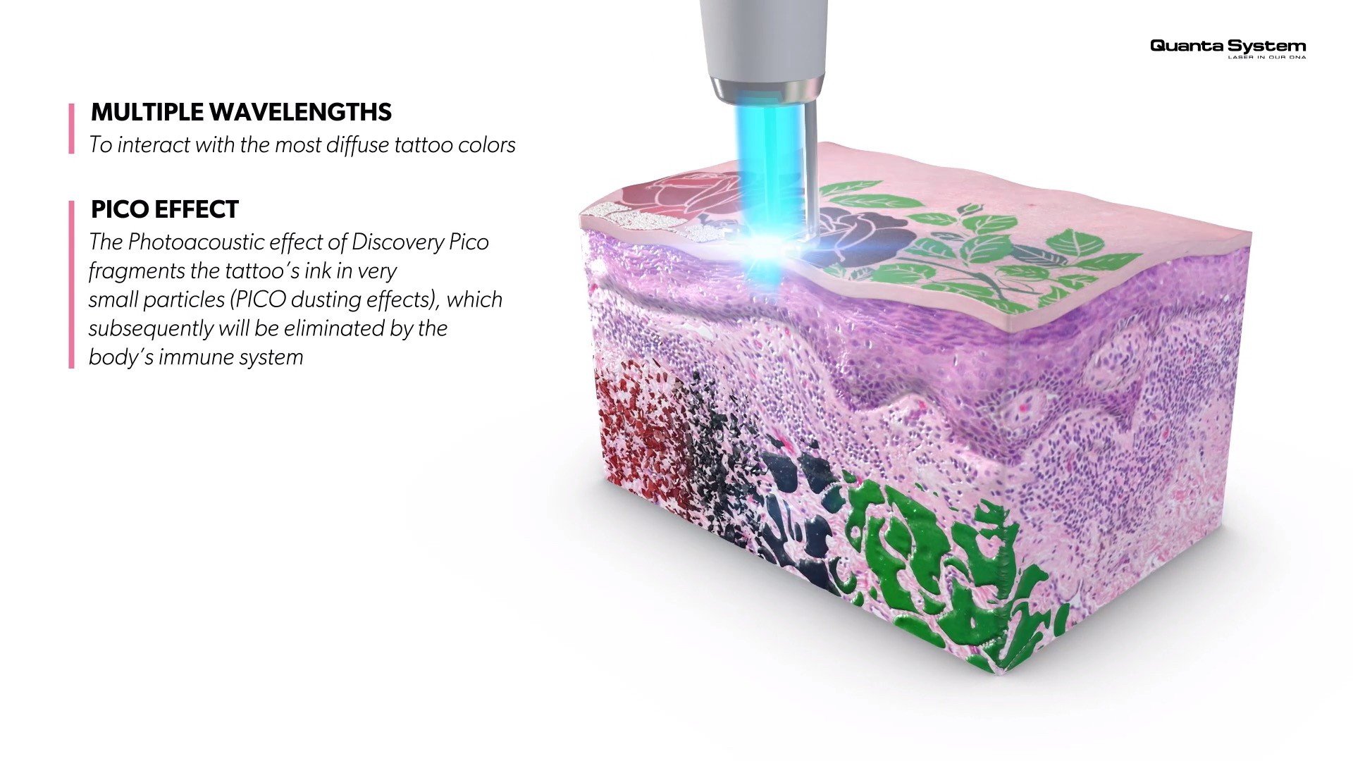 ทำความรู้จัก Discovery Pico Laser เทคนิค จุดเด่นในการดูแลรักษาปัญหาผิวหนัง หลุมสิว รูขุมขนกว้าง กระฝ้า จุดด่างดำ รอยสัก