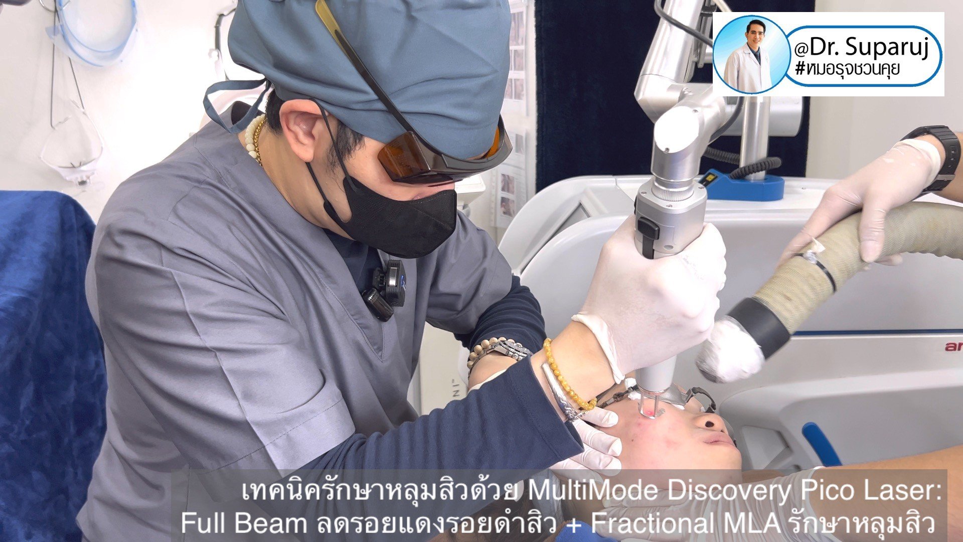 แนะนำเทคนิครักษาหลุมสิว: หัวยิงพิเศษรักษาหลุมสิว Fractional MLA 8 mm. ของ Discovery Pico Laser แนะนำเทคนิครักษาหลุมสิว: หัวยิงพิเศษรักษาหลุมสิว Fractional MLA 8 mm. ของ Discovery Pico Laser
