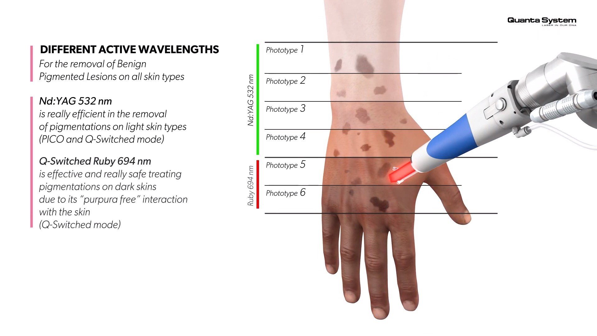ทำความรู้จัก Discovery Pico Laser เทคนิค จุดเด่นในการดูแลรักษาปัญหาผิวหนัง หลุมสิว รูขุมขนกว้าง กระฝ้า จุดด่างดำ รอยสัก ทำความรู้จัก Discovery Pico Laser เทคนิค จุดเด่นในการดูแลรักษาปัญหาผิวหนัง หลุมสิว รูขุมขนกว้าง กระฝ้า จุดด่างดำ รอยสัก