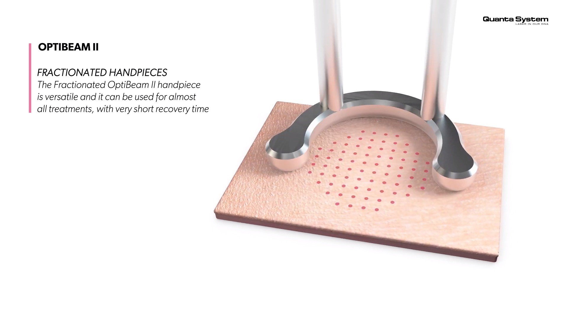 ทำความรู้จัก Discovery Pico Laser เทคนิค จุดเด่นในการดูแลรักษาปัญหาผิวหนัง หลุมสิว รูขุมขนกว้าง กระฝ้า จุดด่างดำ รอยสัก ทำความรู้จัก Discovery Pico Laser เทคนิค จุดเด่นในการดูแลรักษาปัญหาผิวหนัง หลุมสิว รูขุมขนกว้าง กระฝ้า จุดด่างดำ รอยสัก