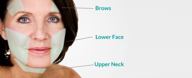 •สกินแคร์อาจจะเริ่มมีบทบาทน้อยลงโดยจะช่วย ให้ผิวไม่เกิดริ้วรอยเพิ่มขึ้นได้ในระดับนึง แต่อาจจะไม่สามารถช่วยลดริ้วรอยที่เกิดขึ้นแล้วได้ครับ (do not reverese aging) โดยอาจใช้ Retinol, Niacinamide, Ascorbic Acid •สกินแคร์อาจจะเริ่มมีบทบาทน้อยลงโดยจะช่วย ให้ผิวไม่เกิดริ้วรอยเพิ่มขึ้นได้ในระดับนึง แต่อาจจะไม่สามารถช่วยลดริ้วรอยที่เกิดขึ้นแล้วได้ครับ (do not reverese aging) โดยอาจใช้ Retinol, Niacinamide, Ascorbic Acid