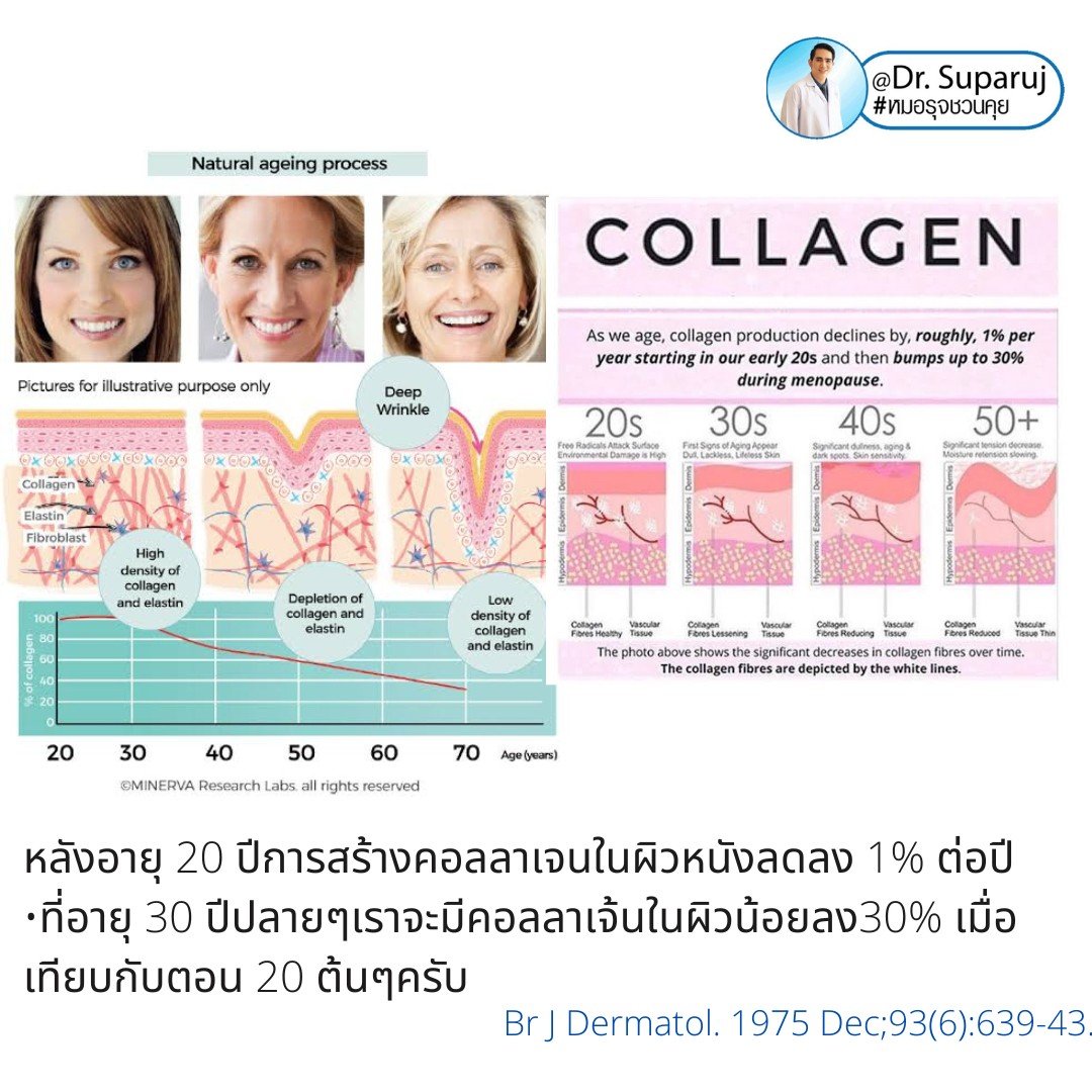 Q: หลังรักษาหลุมสิวด้วยเลเซอร์หรือเทคนิคต่างๆ หลังจากรักษาเรียบร้อยแล้ว จะมีโอกาสกลับมายุบตัว หรือหลุมสิวจะกลับมาแบบเดิมไหม? Q: หลังรักษาหลุมสิวด้วยเลเซอร์หรือเทคนิคต่างๆ หลังจากรักษาเรียบร้อยแล้ว จะมีโอกาสกลับมายุบตัว หรือหลุมสิวจะกลับมาแบบเดิมไหม?