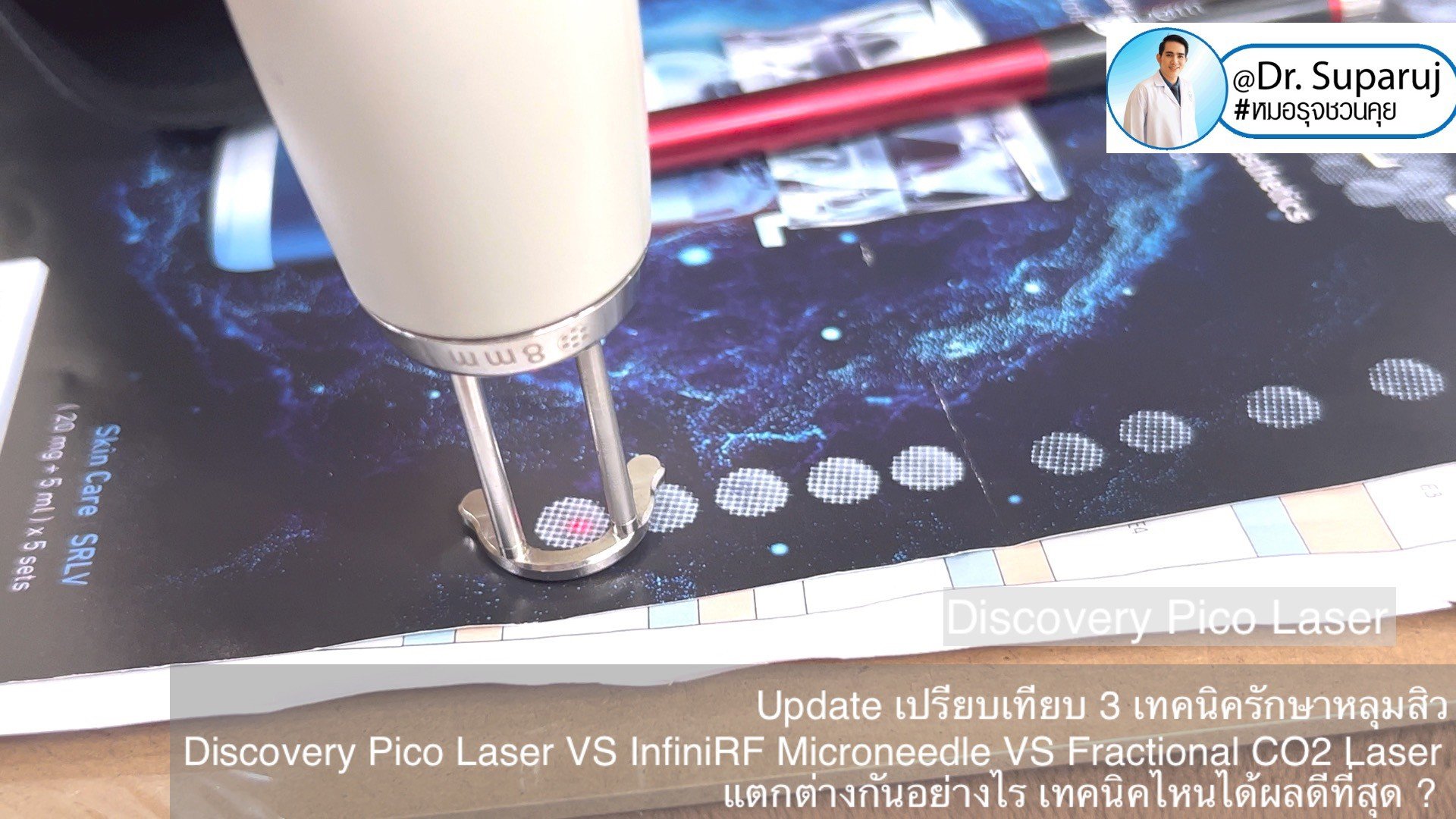 Update เปรียบเทียบ 3 เทคนิครักษาหลุมสิว Discovery Pico Laser VS InfiniRF Microneedle VS Fractional CO2 Laser แตกต่างกันอย่างไร เทคนิคไหนได้ผลดีที่สุด ?