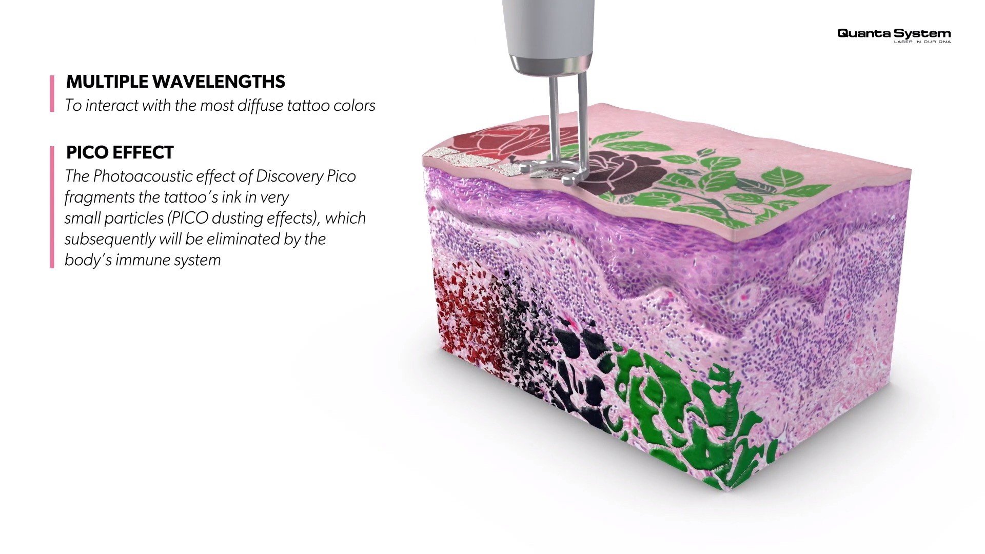 ทำความรู้จัก Discovery Pico Laser เทคนิค จุดเด่นในการดูแลรักษาปัญหาผิวหนัง หลุมสิว รูขุมขนกว้าง กระฝ้า จุดด่างดำ รอยสัก ทำความรู้จัก Discovery Pico Laser เทคนิค จุดเด่นในการดูแลรักษาปัญหาผิวหนัง หลุมสิว รูขุมขนกว้าง กระฝ้า จุดด่างดำ รอยสัก