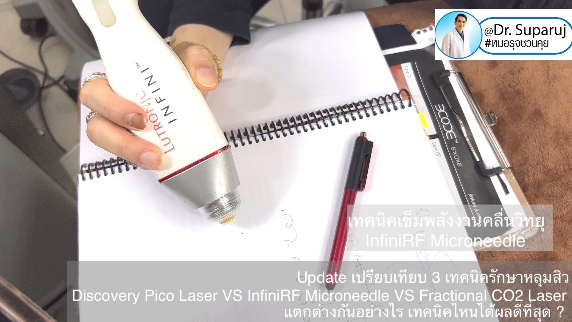 Update เปรียบเทียบ 3 เทคนิครักษาหลุมสิว Discovery Pico Laser VS InfiniRF Microneedle VS Fractional CO2 Laser แตกต่างกันอย่างไร เทคนิคไหนได้ผลดีที่สุด ? Update เปรียบเทียบ 3 เทคนิครักษาหลุมสิว Discovery Pico Laser VS InfiniRF Microneedle VS Fractional CO2 Laser แตกต่างกันอย่างไร เทคนิคไหนได้ผลดีที่สุด ?