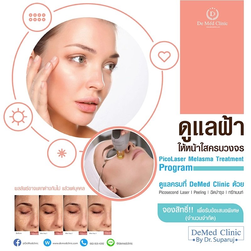 PicoLaser Melasma Treatment Program โปรแกรมดูแลฝ้าครบวงจร PicoLaser Melasma Treatment Program โปรแกรมดูแลฝ้าครบวงจร
