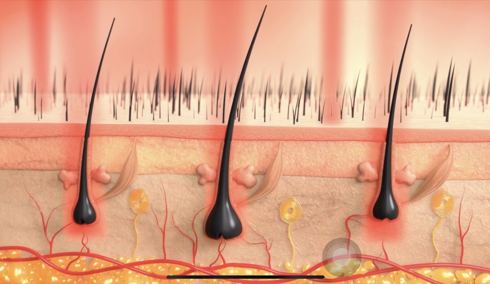 Hair Fraxel Regrow: เลเซอร์กระตุ้นรากผม ดูแลผมร่วงผมบาง Hair Fraxel Regrow: เลเซอร์กระตุ้นรากผม ดูแลผมร่วงผมบาง