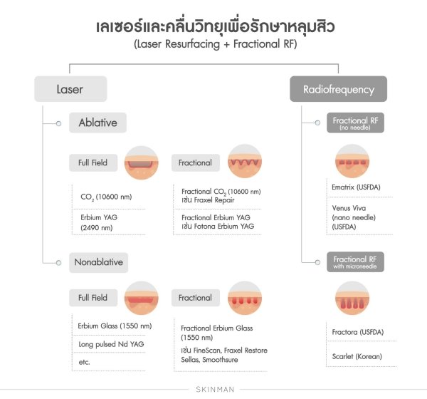 Fractional RF เป็นการนำเอา พลังงานคลื่นวิทยุ RF มาผสมผสานให้เป็นแบบ Fractional