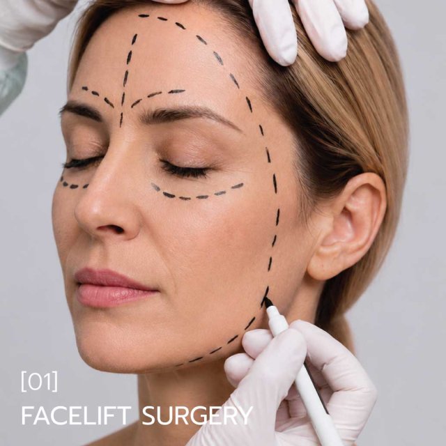 Deep Plane Facelift