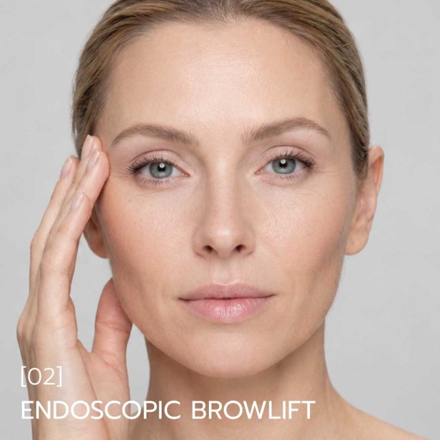Endoscopic Brow Lift