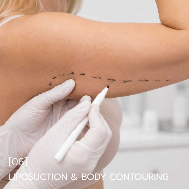 Liposuction & Body Contouring