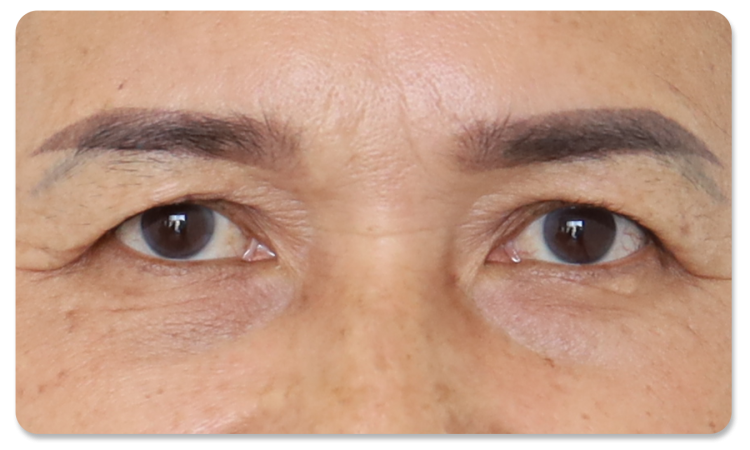 ทำตาสองชั้น