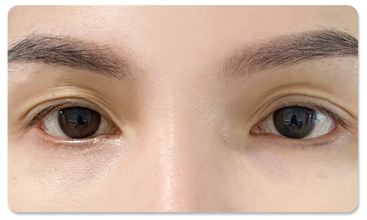 ทำตาสองชั้น