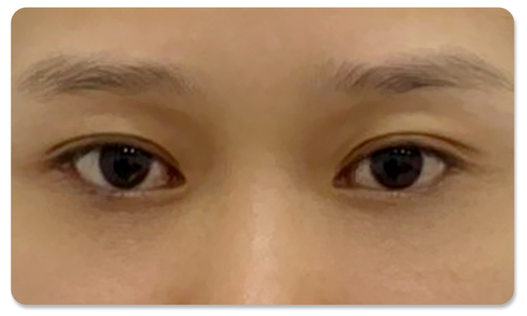 ทำตาสองชั้น