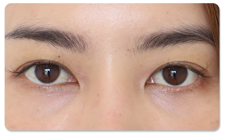 ทำตาสองชั้น