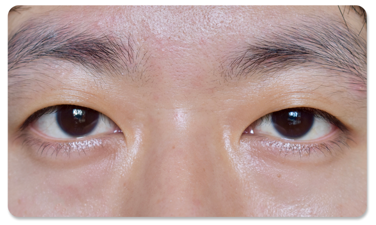 ทำตาสองชั้น