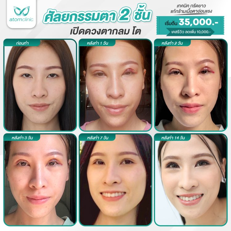 ทำตาสองชั้น