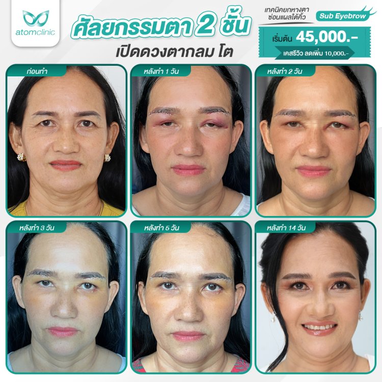 ทำตาสองชั้น