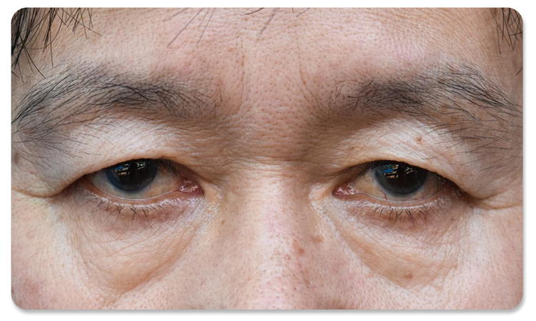 ทำตาสองชั้น