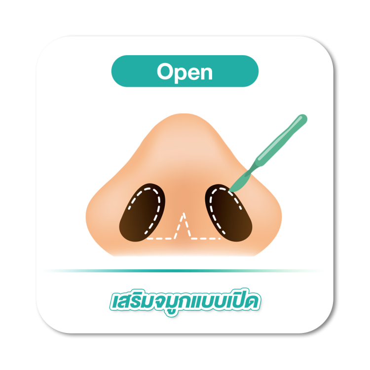 เสริมจมูก