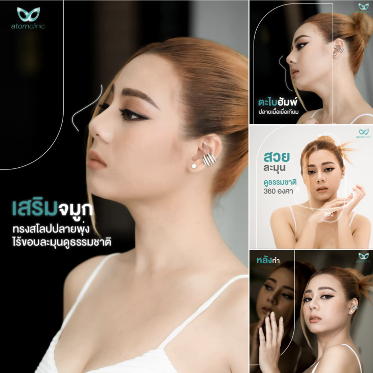 เสริมจมูก