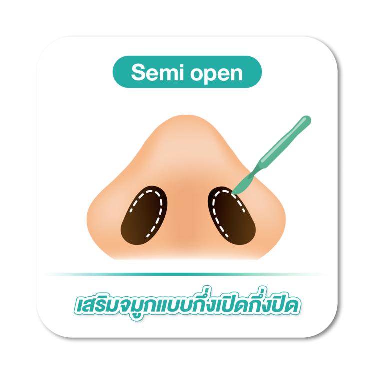 เสริมจมูก