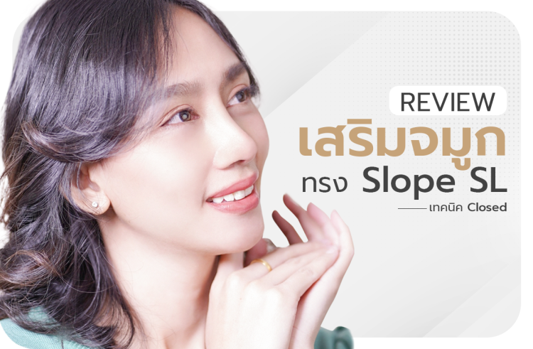 รีวิวเสริมจมูก closed