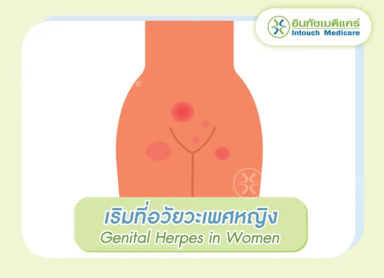เริมอวัยวะเพศหญิง เริมอวัยวะเพศหญิง