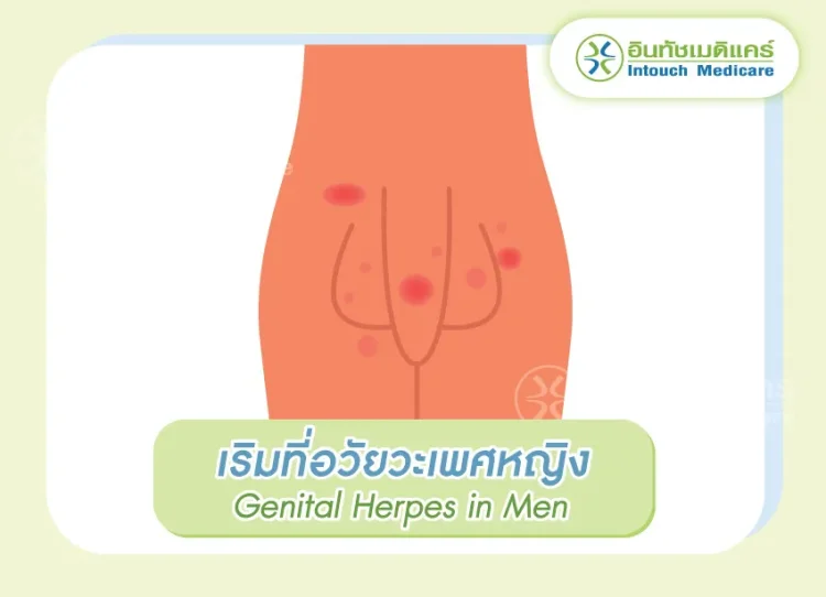 เริมอวัยวะเพศชาย เป็นตุ่ม เริมอวัยวะเพศชาย เป็นตุ่ม
