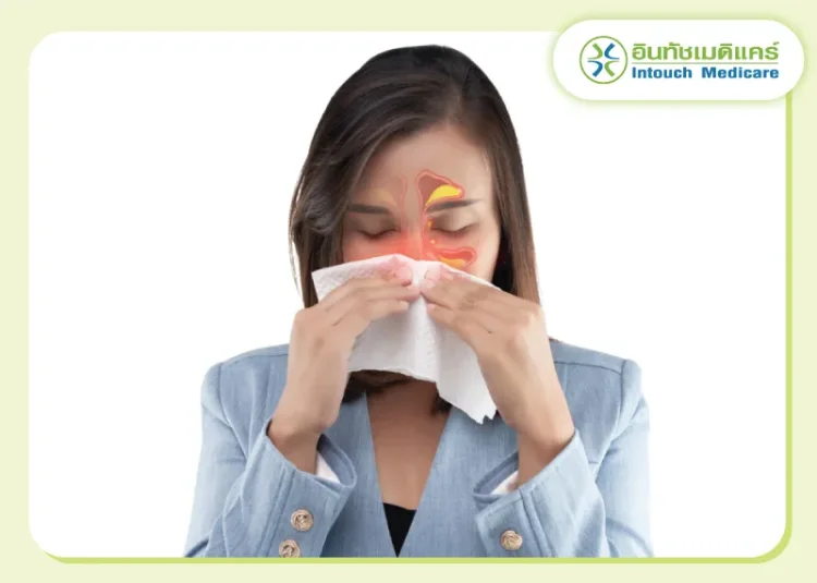 ไซนัสอักเสบ