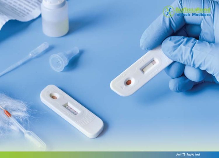 Anti TB Rapid test Anti TB Rapid test