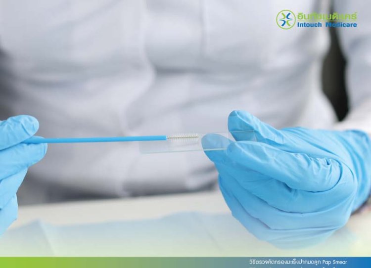 ตรวจคัดกรองมะเร็งปากมดลูก Pap Smear ตรวจคัดกรองมะเร็งปากมดลูก Pap Smear