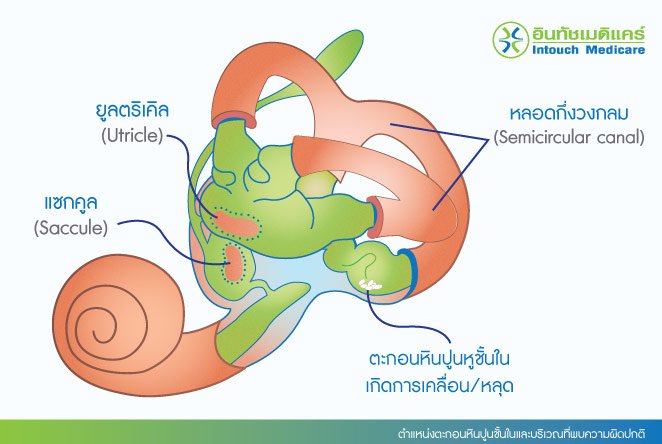 ตำแหน่งตะกอนหินปูนชั้นในและบริเวณที่พบความผิดปกติ